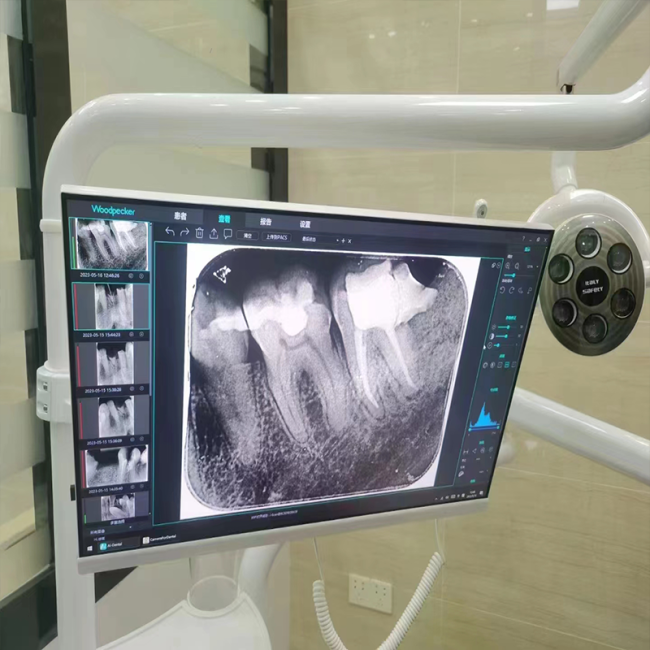 Dentalisches WLAN All-in-One-Intraorale Camera mit 24-Zoll-Touchscreen